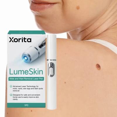 Electric Laser Plasma Pen Mole Removal Dark Spot Remover Skin Wart Tag Remover